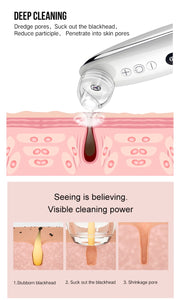 Visual Blackhead Remover with HD Camera